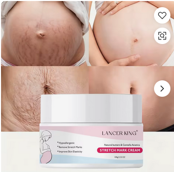 Crema Pentru Vindecarea Vergeturilor.